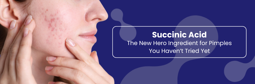 Succinic Acid: The New Hero Ingredient for Pimples You Haven’t Tried Yet