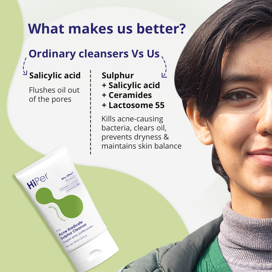 Acne Eradicate Sulphur Cleanser | Face wash for acne prone skin | Salicylic Acid Face Wash