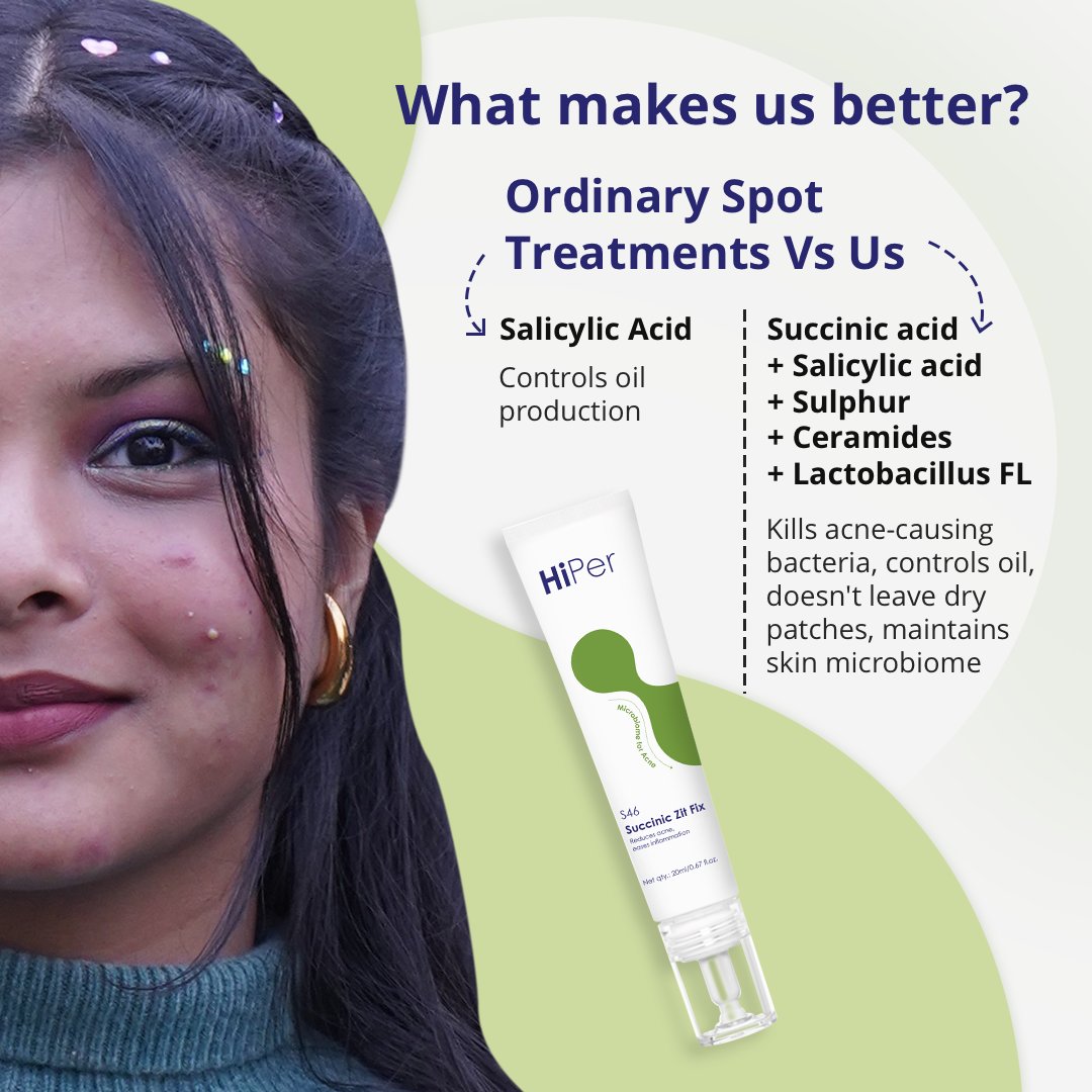 Succinic Zit Fix Acne Spot Corrector | Spot Treatment for Acne & Pimples | Shrink Active Acne