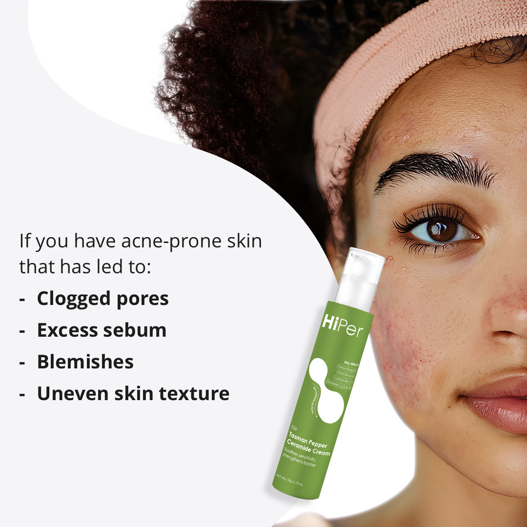 Ceramide Cream for Oily & Acne-Prone Skin | Lightweight, Oil-Free Moisturizer | Powered by Tasman Pepper