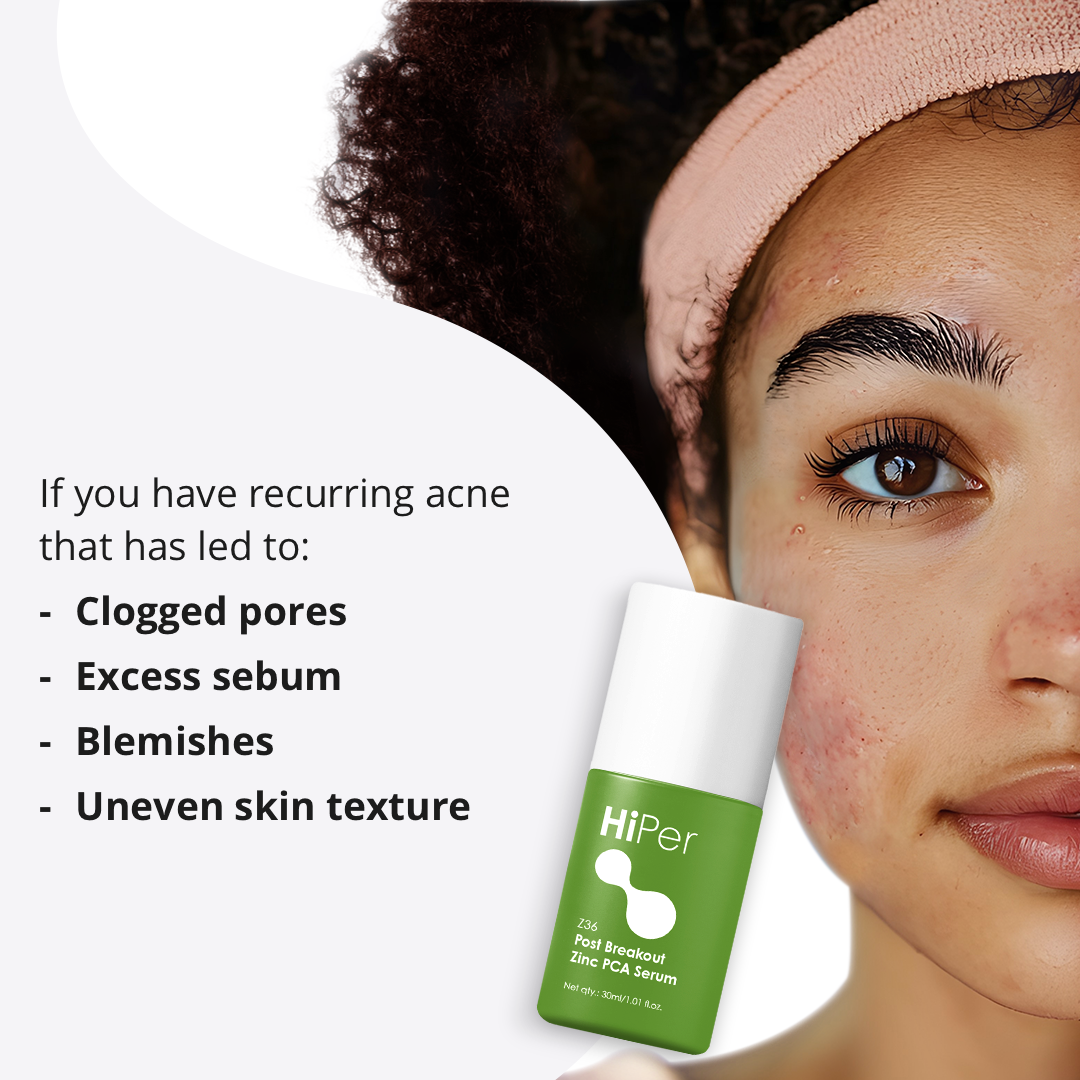 Post Breakout Zinc PCA Serum | Serum for oily skin | Serum for acne marks | Niacinamide Serum