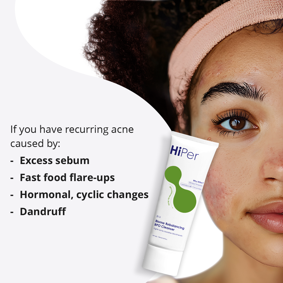 Biome Rebalancing Benzoyl Peroxide Cleanser | Face Wash for Acne Prone Skin