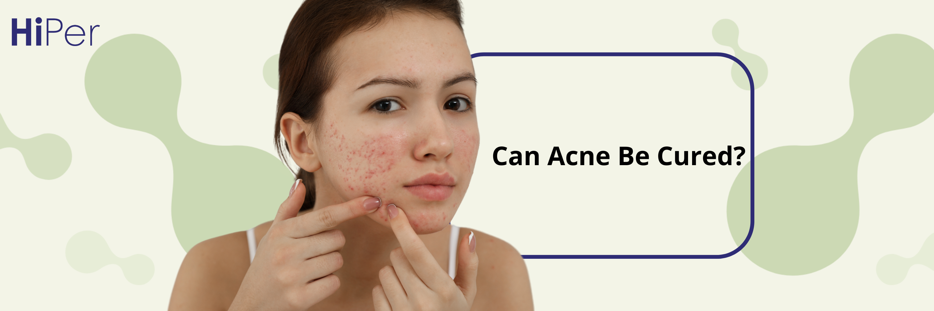 Can Acne Be Cured? Everything You Need to Know About Pimples, Scars, and Skin Care
