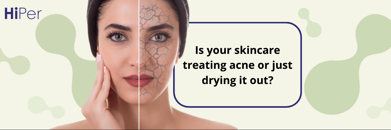 Is your skincare treating acne or just drying it out?