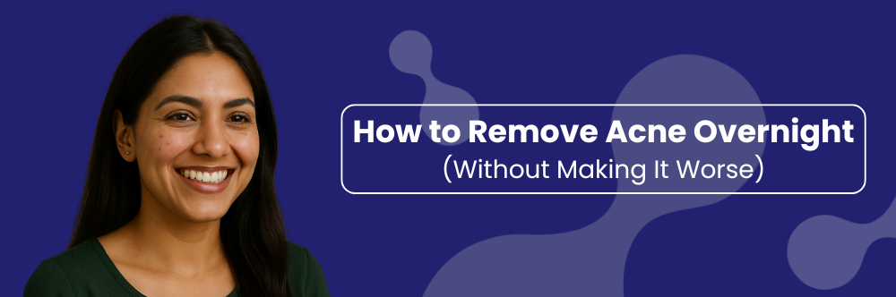 How to Remove Acne Overnight (Without Making It Worse)