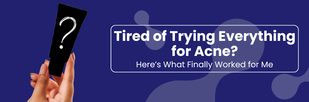 Tried Every Solution For Acne? Here’s What Finally Worked for Me