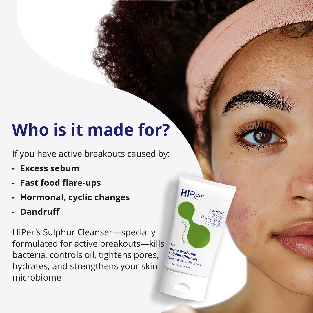 Acne Eradicate Sulphur Cleanser